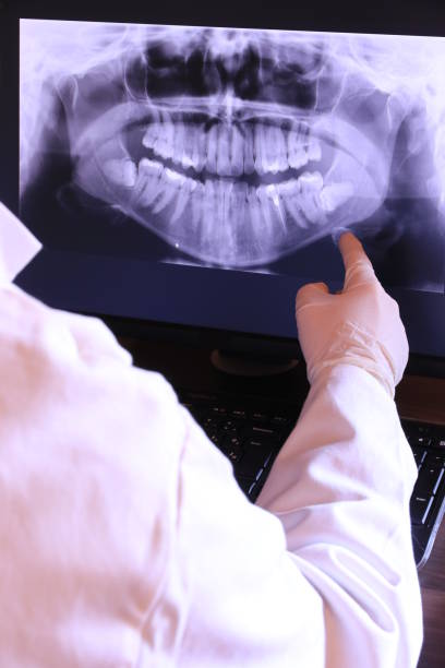 Best Emergency Dentist for Knocked-Out Tooth in Gloucester City, NJ